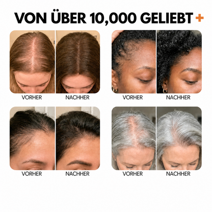 Veylla™ Haarwuchsserum