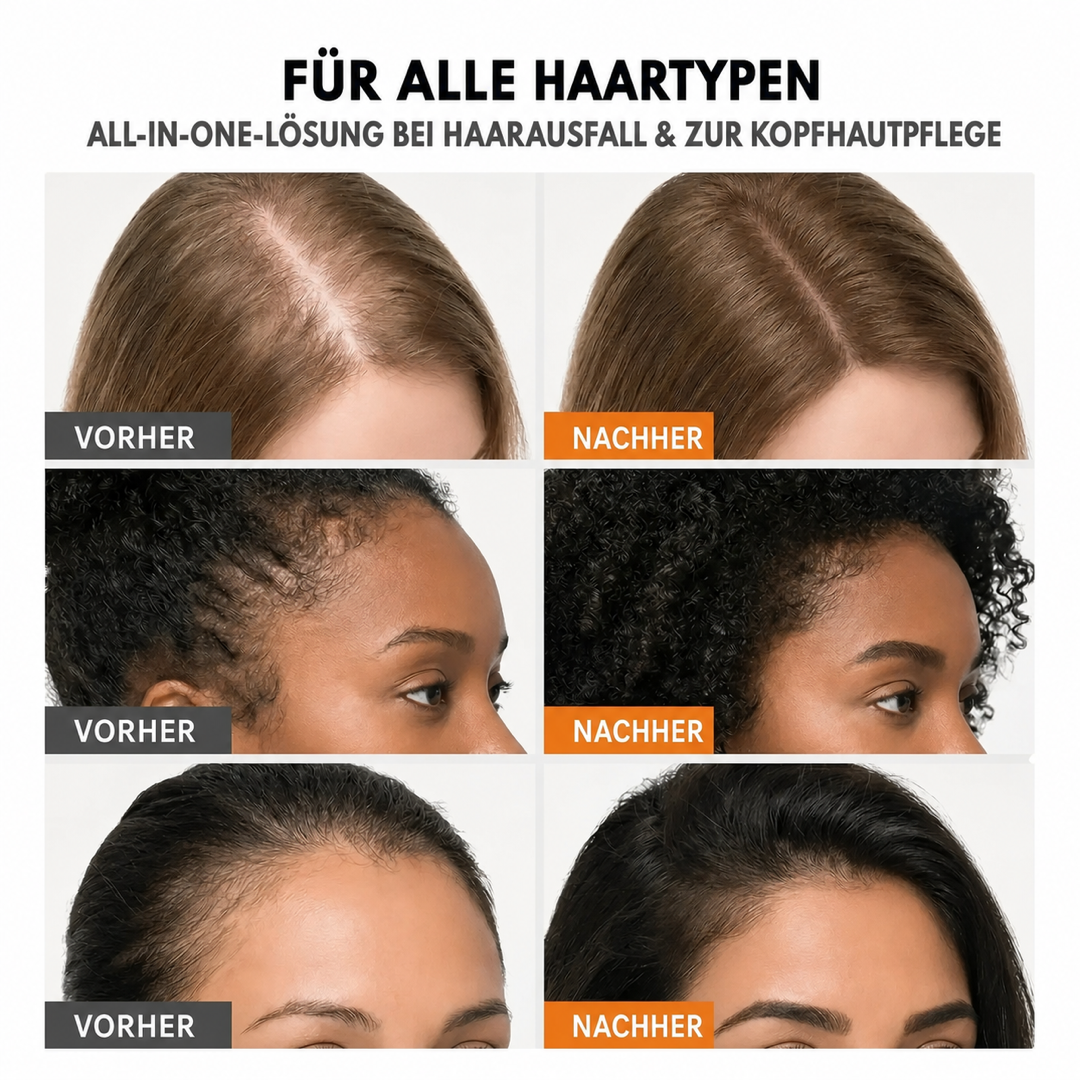 Veylla™ Haarwuchsserum