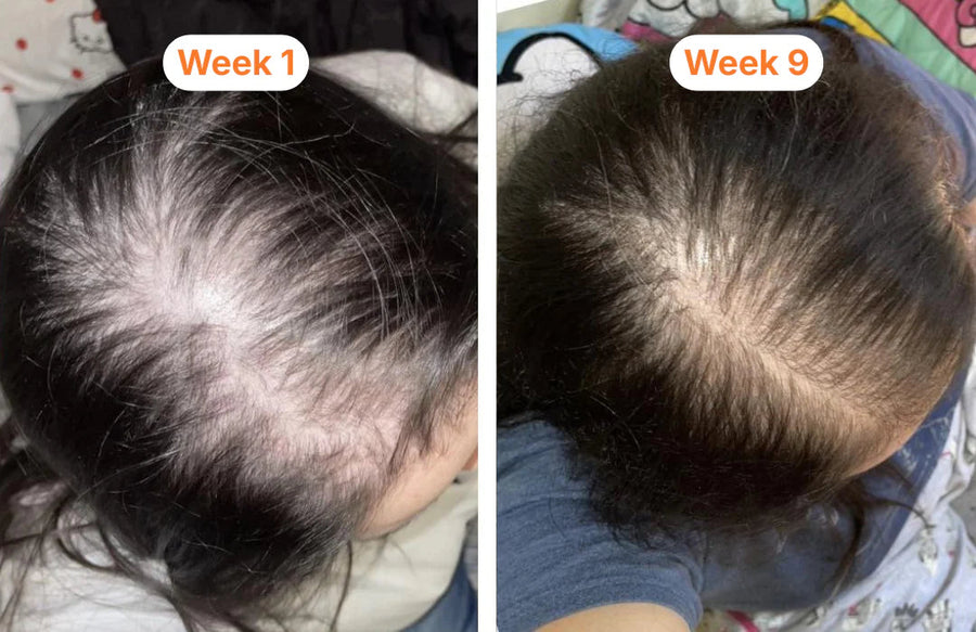 Veylla Kundin mit Haarserum